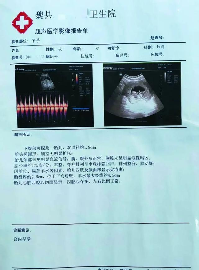 精神病女患者住院期间被男护工致孕，医院甩得了锅吗？